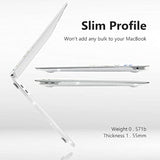 Compatible With Macbook Air 13 Inch Case 2022, 2021-2018 Release A2337 M1 A2179 A1932 Retina Display, Clear Plastic Hard Shell Case + Keyboard Cover + Screen Protector, Lavender Glitter