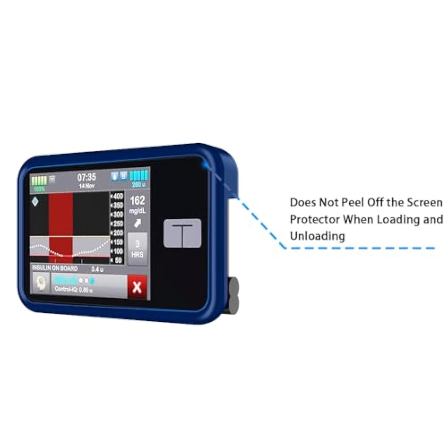 Protective Case For Tandem T:Slim X2 Pump With Built-In Metal Belt Clip (Strong & Durable Case For Tandem Diabetes Care Tslim X2 Insulin Pump) - Blue