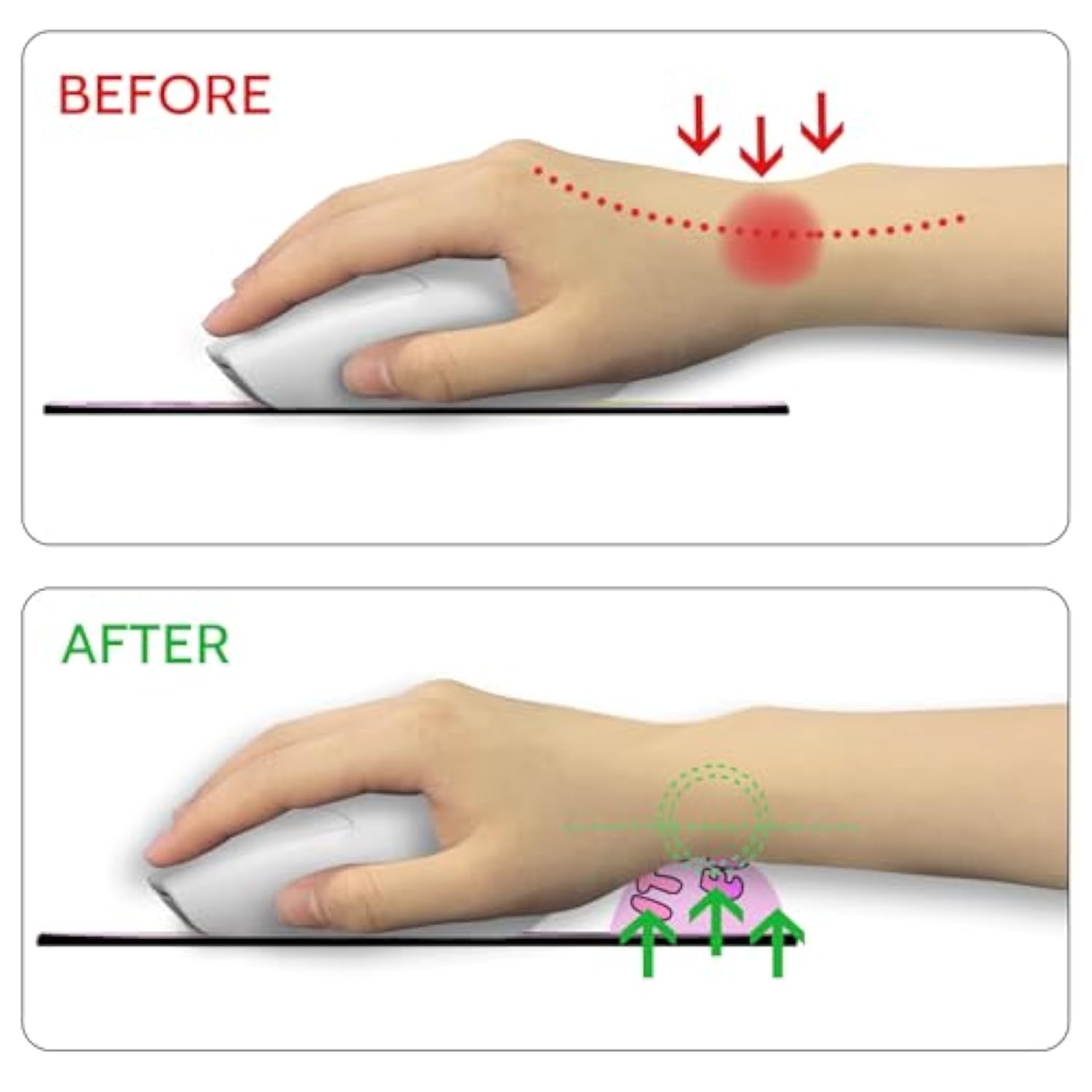 Dumpster On Fire Mouse Pad With Wrist Rest, Funny Cute Ergonomic Mouse Pads For Desk Wrist Support, Mousepad For Wireless Mouse Gaming Work Home Desk Accessories Office Supplies Decor Women