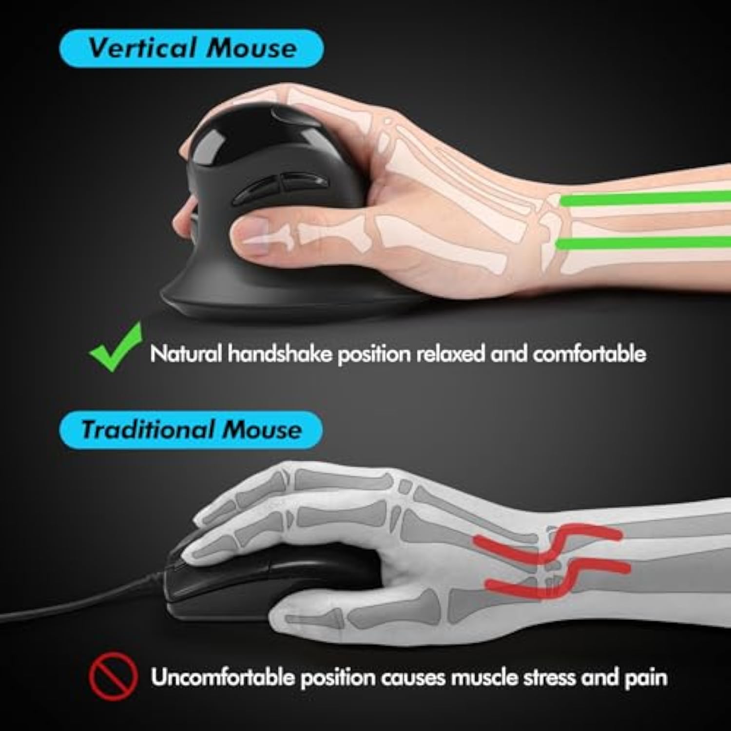 Ergonomic Mouse, Vertical Wireless Mouse With Usb A & Type-C Receiver, Ergo De