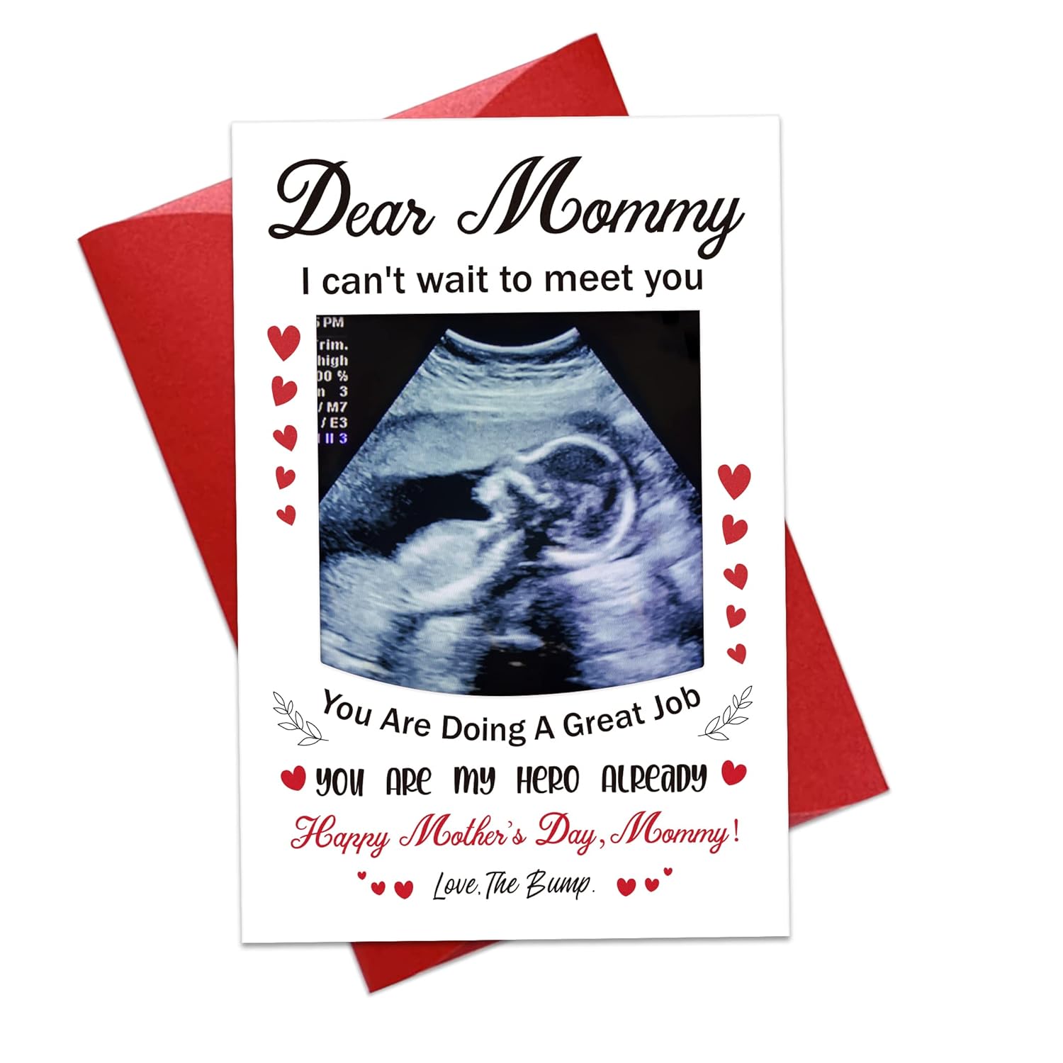 First Mothers Day Card For Mom From Bump Happy 1St Mothers Day Photo Frame Card With Envelope First Mothers Day Pregnancy Gift Card For First Time Mom New Mom Expecting Mom Mother To Be