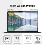 Magnetic Macbook Anti Blue Light Screen Protector Anti Glare Screen Filter Blue Light Blocking And Relieve Eyestrain Compatible For Macbook Pro 13 2016 2020 M1 Air 13 2018 2020 M1